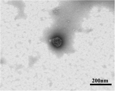 Emerging Potential of Exosomes on Adipogenic Differentiation of Mesenchymal Stem Cells